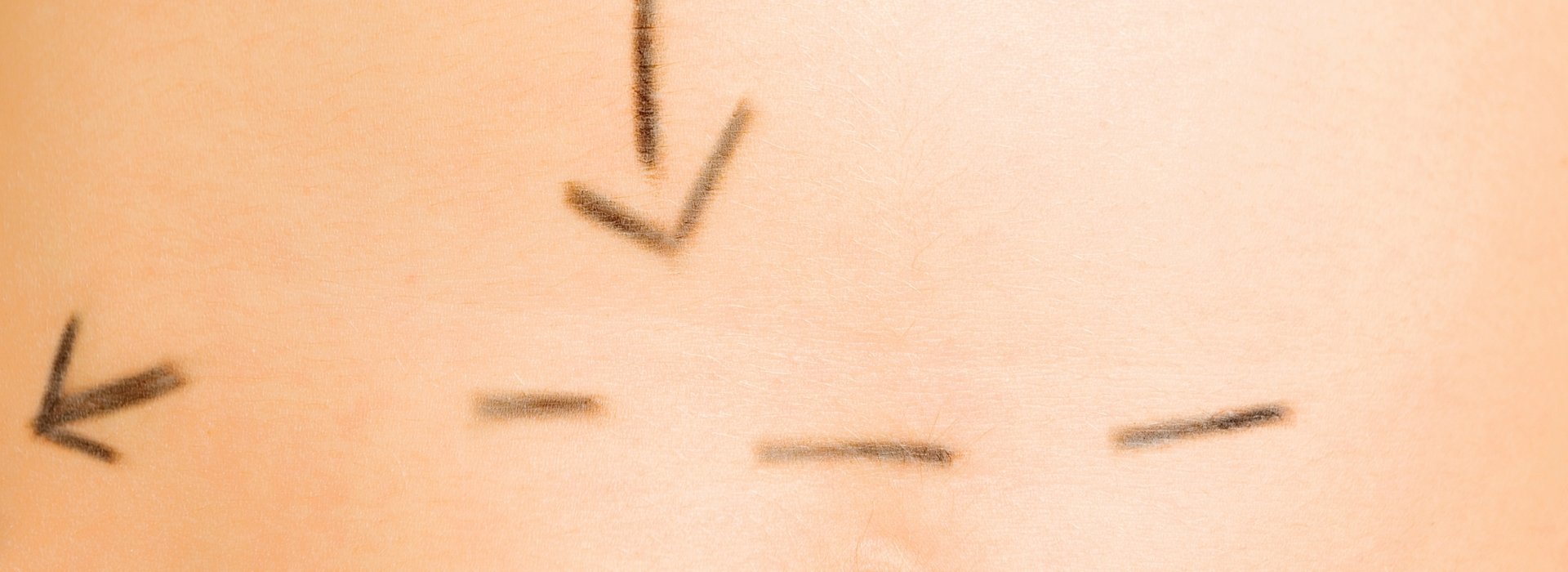 Skin treatments