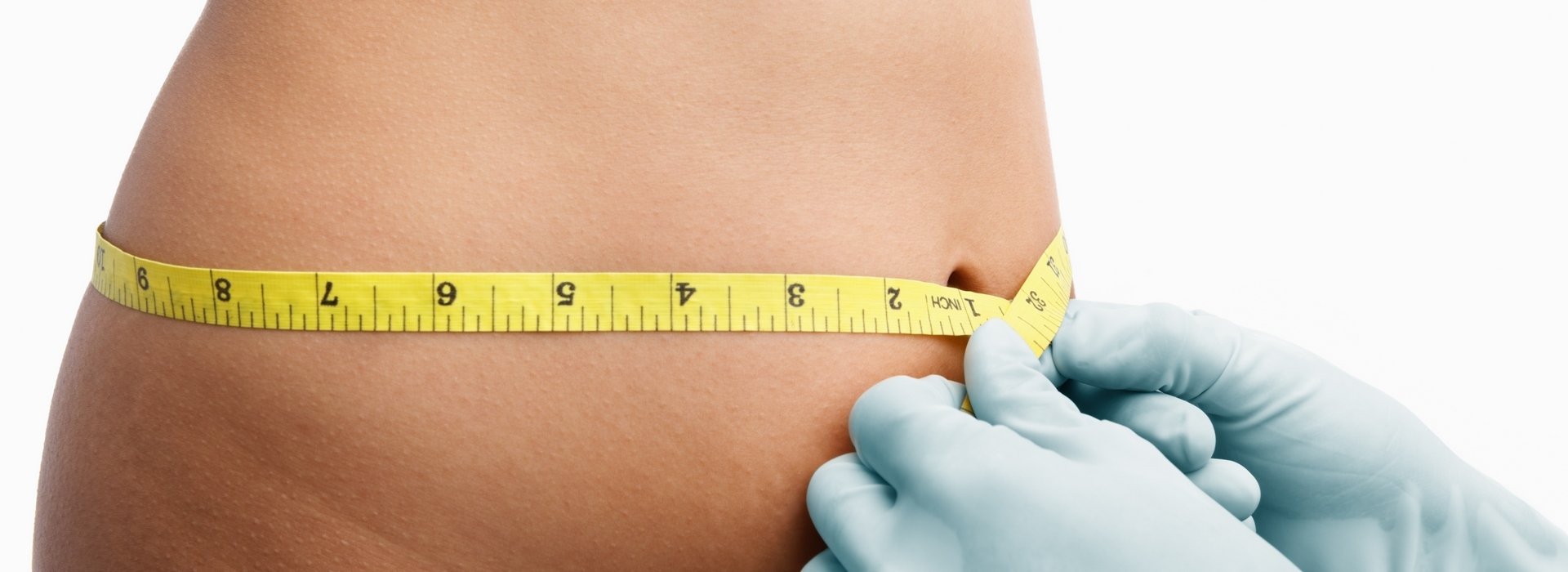 Liposuction
