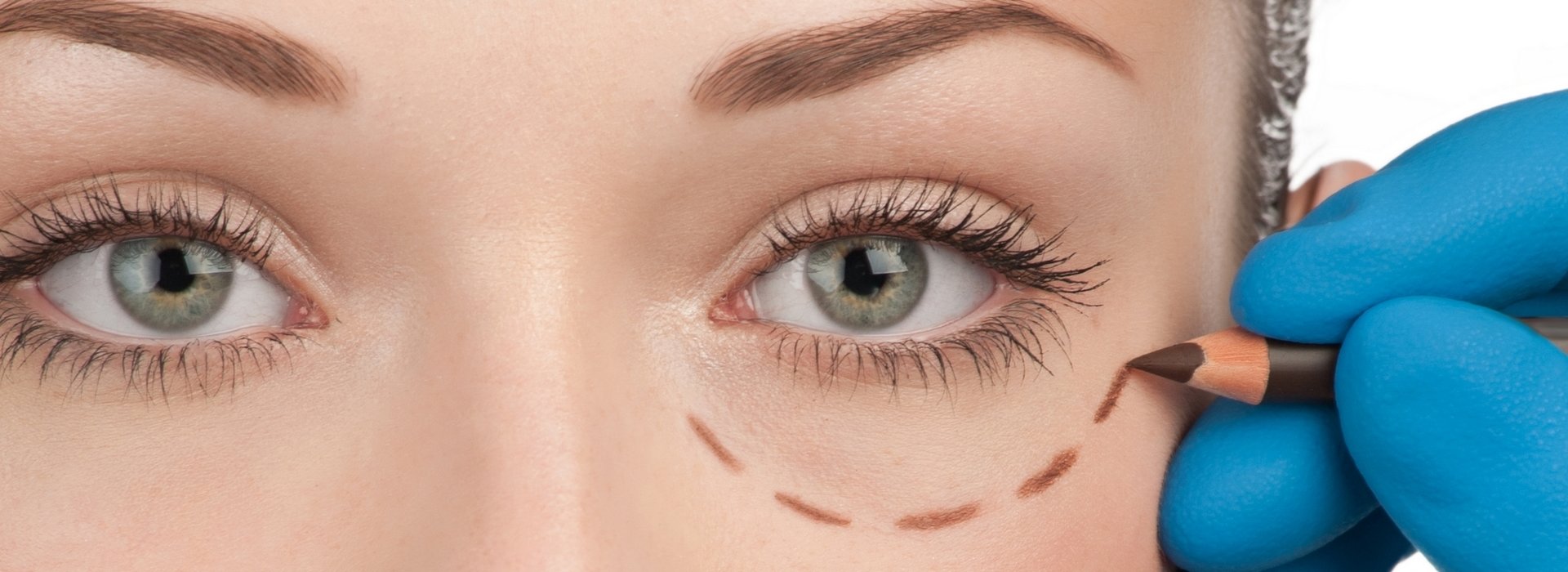 Other cosmetic surgery